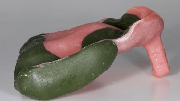 Newsletter 79 – Creating a wonderful smile and changing a life.