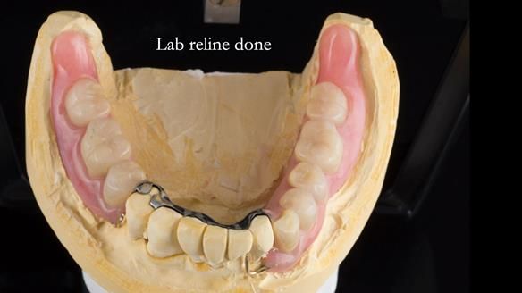 Ken – going downhill, first class