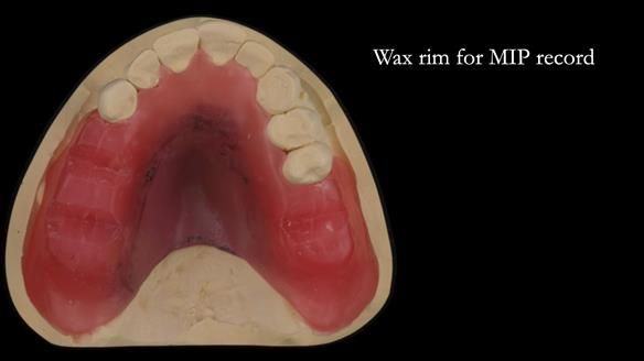 Ken – going downhill, first class