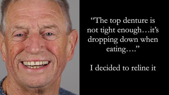 Newsletter 54 case presentation upper complete denture and lower Scandinavian designed hygienic partial denture for David