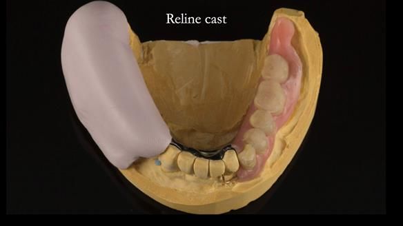 Ken – going downhill, first class