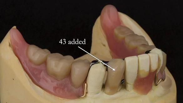 Ken – going downhill, first class