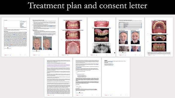 Newsletter 57 showcases the making and fitting process of implant-supported complete dentures for Alisdair