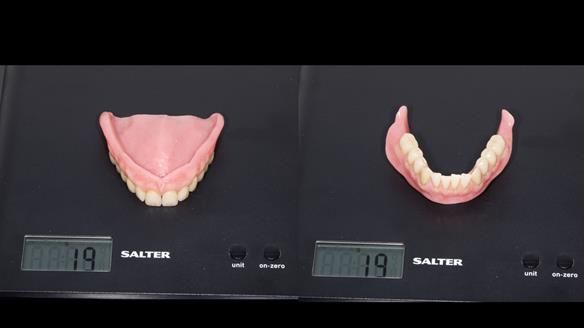 Newsletter 80 - Gordon’s dentures: the one case in 1,000 where my technique failed