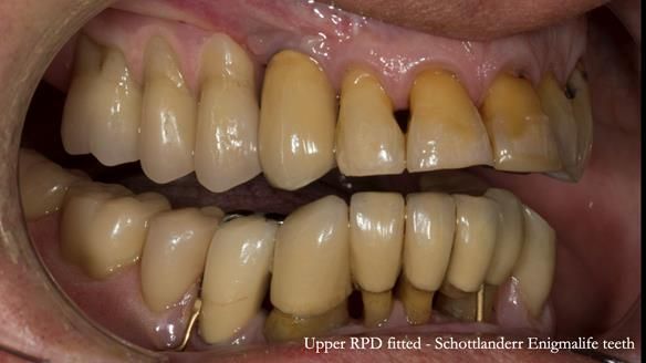 Ken – going downhill, first class