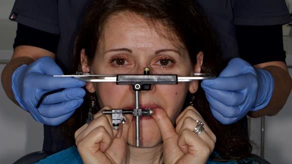 Newsletter 79 – Creating a wonderful smile and changing a life.