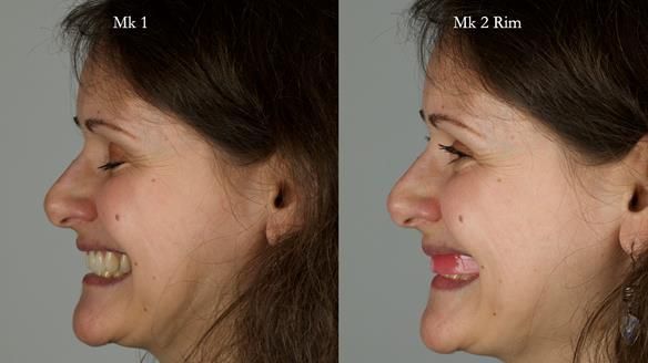 Newsletter 79 – Creating a wonderful smile and changing a life.