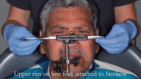 Finlay's Newsletter 62 provision of extractions and metal based complete dentures for Rafique