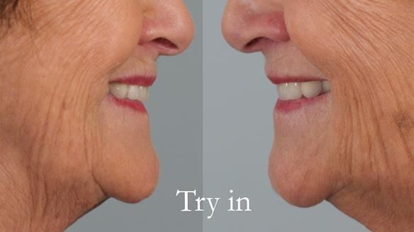 Photos are taken first