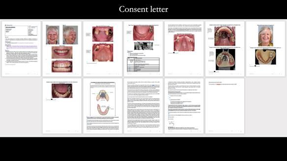 Finlay's Newsletter 59 Ultra hard partial dentures made for Gill