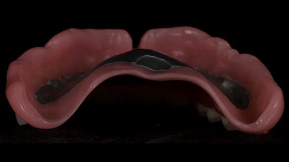 Newsletter 79 – Creating a wonderful smile and changing a life.