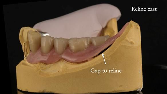 Ken – going downhill, first class
