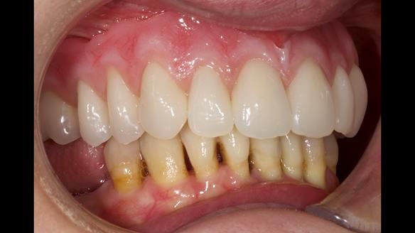 Newsletter 79 – Creating a wonderful smile and changing a life.