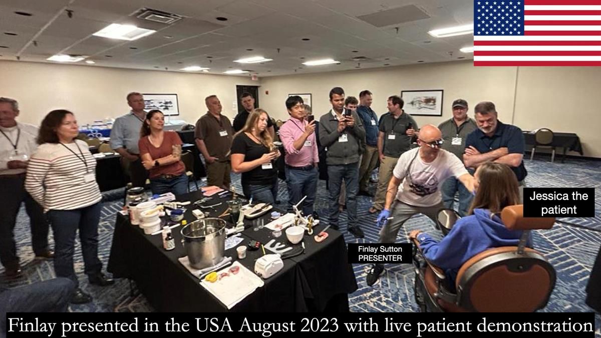 Newsletter 56 showing the making and fitting of a bilateral free end saddle upper removable partial denture (RPD) for patient with pemphigus