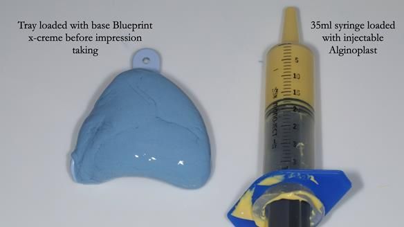 Newsletter 78: What do Clark Gable and a Locator® overdenture have in common?