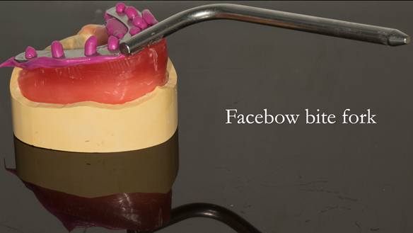 Figure 87 Facebow bite-fork fitted with Futar D to the upper rim