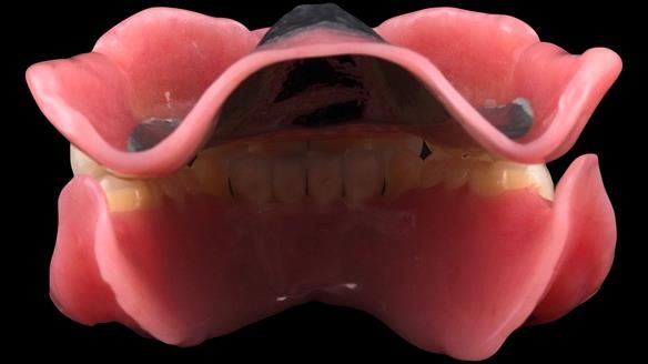 Newsletter 50 Special edition Complete Dentures FULL PROTOCOL