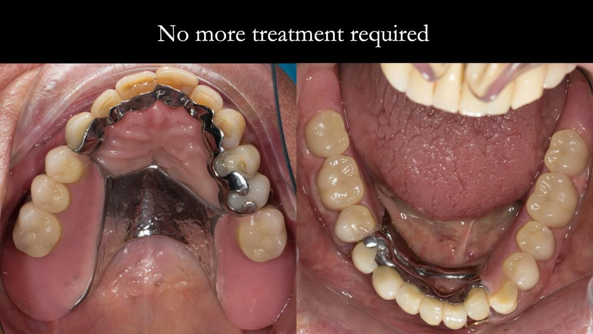 Ken – going downhill, first class