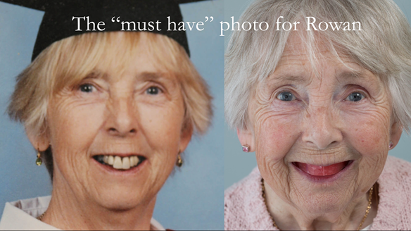 Figure 77 The technician must receive both of these photographs to allow arrangement of the artificial teeth in the same positions as the natural ones