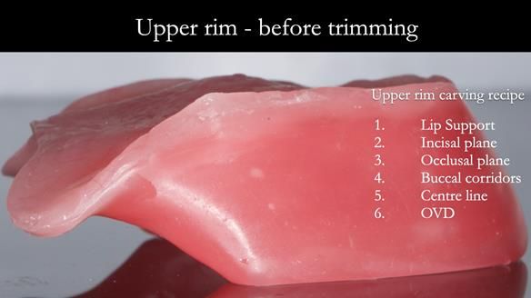Replacing Madeline’s Complete denture FULL PROTOCOL