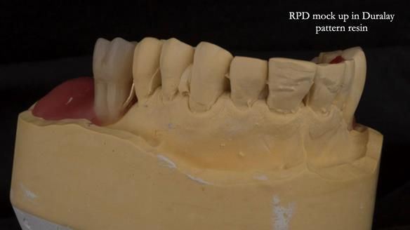 Ken – going downhill, first class