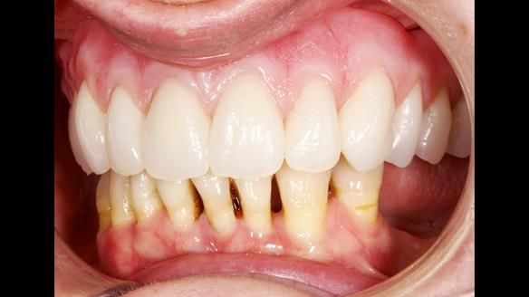 Newsletter 79 – Creating a wonderful smile and changing a life.