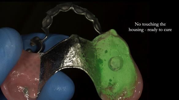 Ken – going downhill, first class