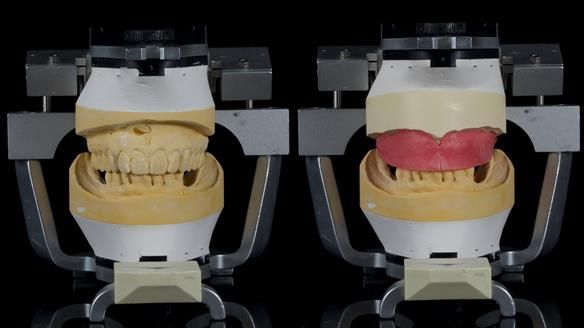 Newsletter 79 – Creating a wonderful smile and changing a life.