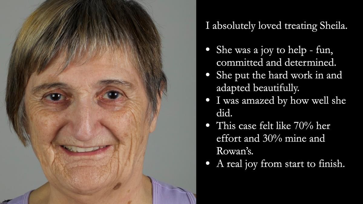 Newsletter 83: Sheila’s Complete Denture Success