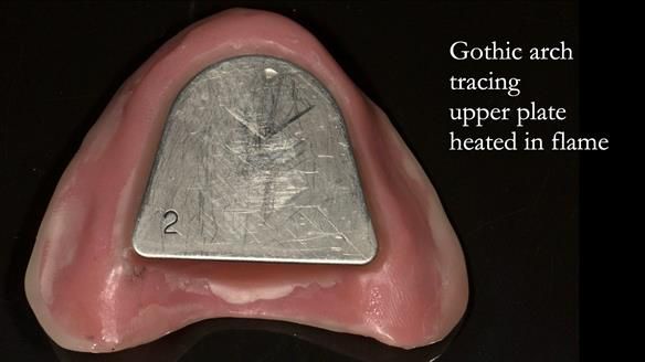 The next few slides show how to use the gothic arch tracing system