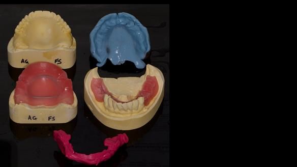 Newsletter 79 – Creating a wonderful smile and changing a life.