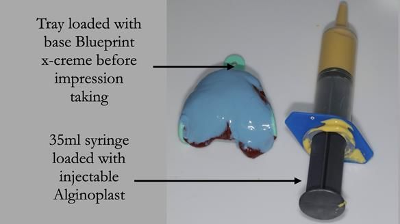 Newsletter 55 Provision of metal based partial dentures for Zephyrine with a repaired cleft lip and palate