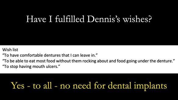 Newsletter 50 Special edition Complete Dentures FULL PROTOCOL