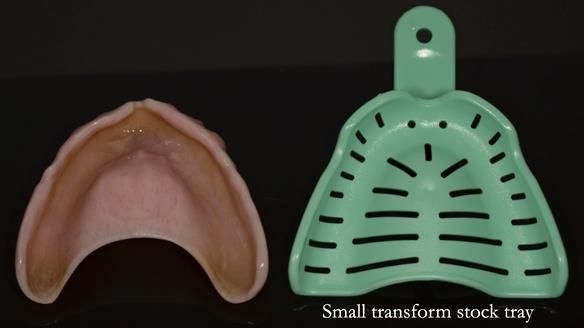 Newsletter 75: Marion’s case - Step-by-step complete denture workflow