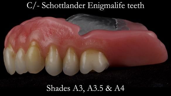 Newsletter 50 Special edition Complete Dentures FULL PROTOCOL