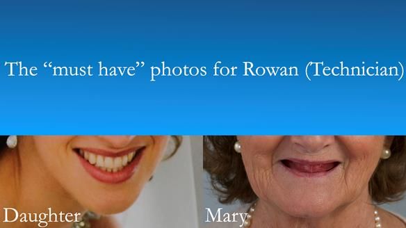 These are the must have photographs for the technician. Mary wanted her smile to be similar to her daughters. I have preserved Mary’s and her daughter’s anonymity in this slide but the technician will get full face photos.