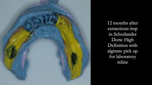 Ken – going downhill, first class