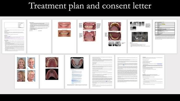 Newsletter 52 Managing Jo’s failing dentition with extractions and Mk 1/Mk 2 complete upper dentures and lower partial dentures FULL PROTOCOL