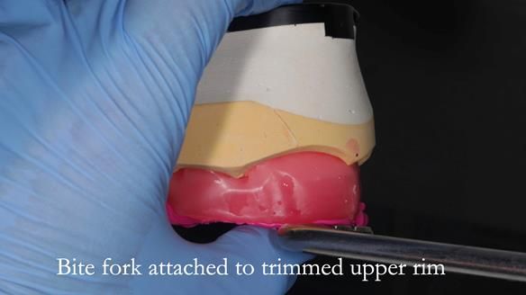 Finlay's Newsletter 58 Gasket upper partial denture for Zoe