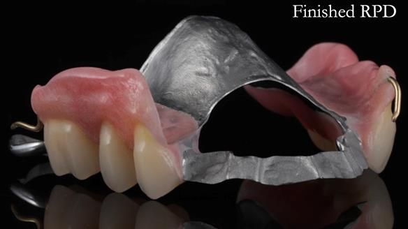 Finlay's Newsletter 60 Sylvia's upper Kennedy Class 2 Mod 1 metal based upper RPD