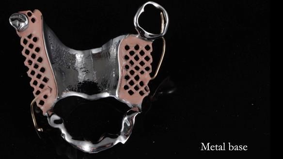 Finlay's Newsletter 60 Sylvia's upper Kennedy Class 2 Mod 1 metal based upper RPD