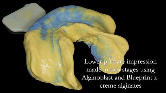 Newsletter 50 Special edition Complete Dentures FULL PROTOCOL