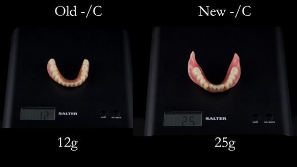Newsletter 50 Special edition Complete Dentures FULL PROTOCOL
