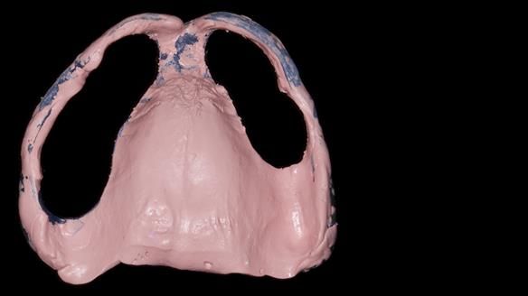 Newsletter 79 – Creating a wonderful smile and changing a life.