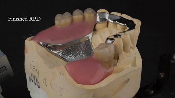 Ken – going downhill, first class