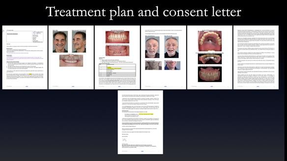 Newsletter 78: What do Clark Gable and a Locator® overdenture have in common?