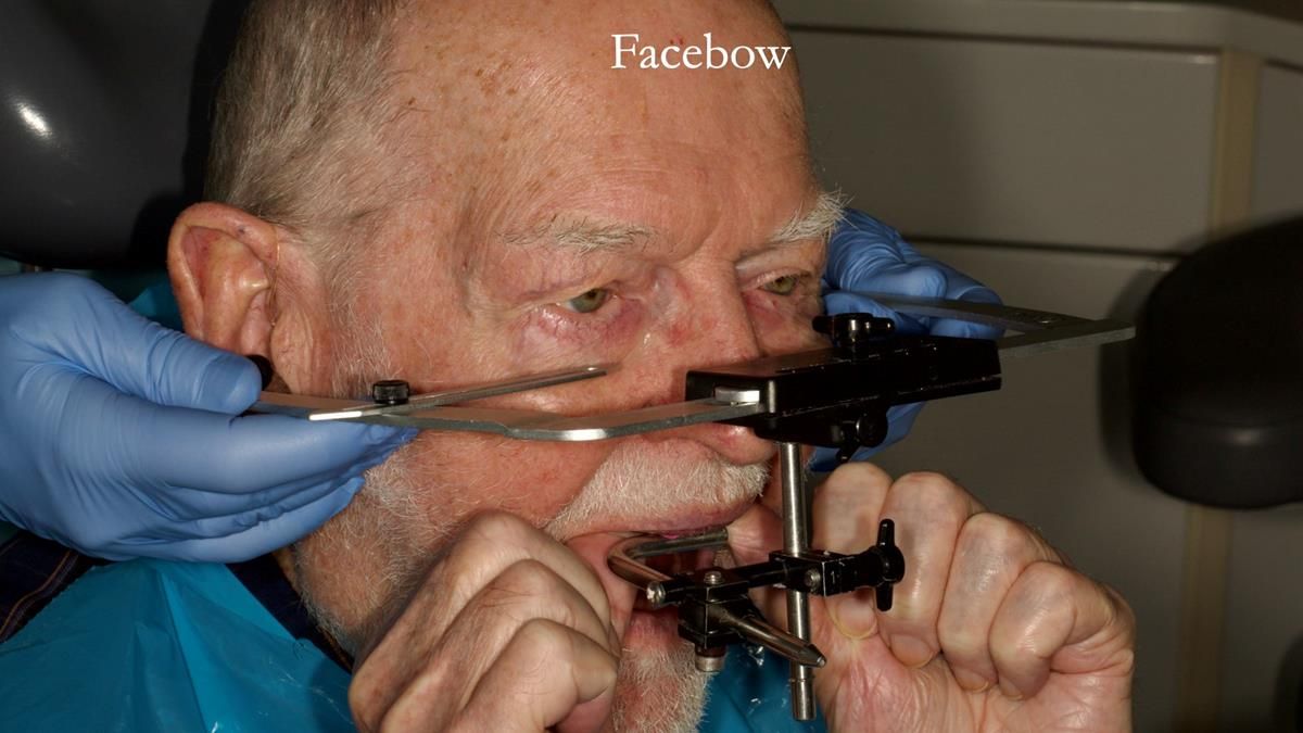 Newsletter 87 – Father Peter: A Partial Denture that needed Minor Miracle
