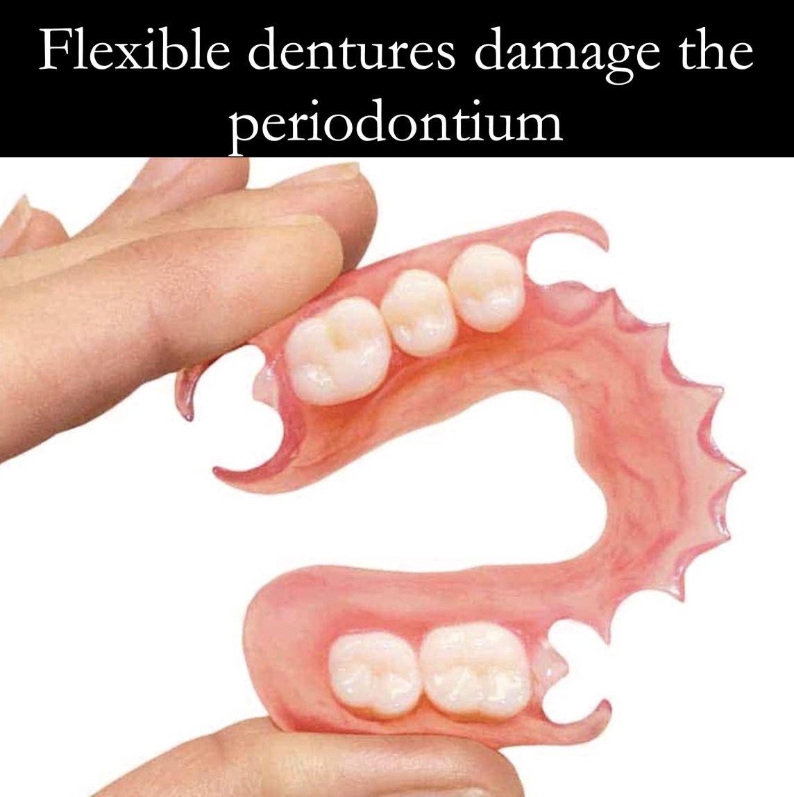 Flexible dentures are bad