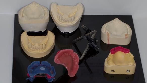 Newsletter 79 – Creating a wonderful smile and changing a life.