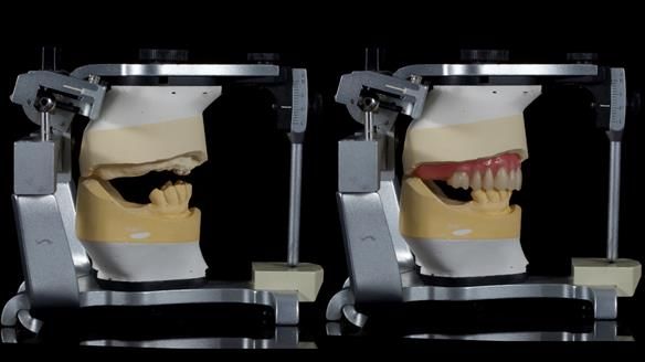 Newsletter 79 – Creating a wonderful smile and changing a life.